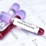 Anti-Rubella-IgG :   ,   ,  ,  